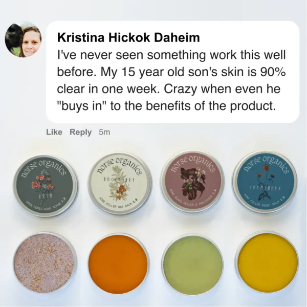 The Complete Acne Killer System 2.0 - Image 7