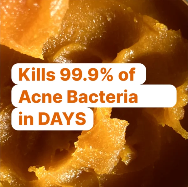 The Complete Acne Killer System 2.0 - Image 13